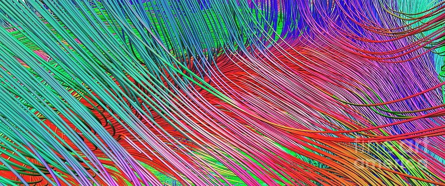 Brain Fibres From Corpus Callosum And Cingulum Photograph by Do Tromp ...