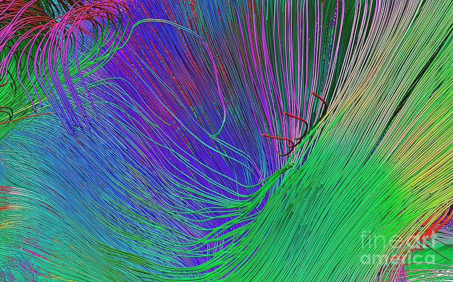 Brain Fibres From Internal Capsule Photograph by Do Tromp/science Photo ...
