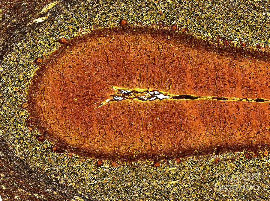 Brain Tissue #1 Photograph by Microscape/science Photo Library