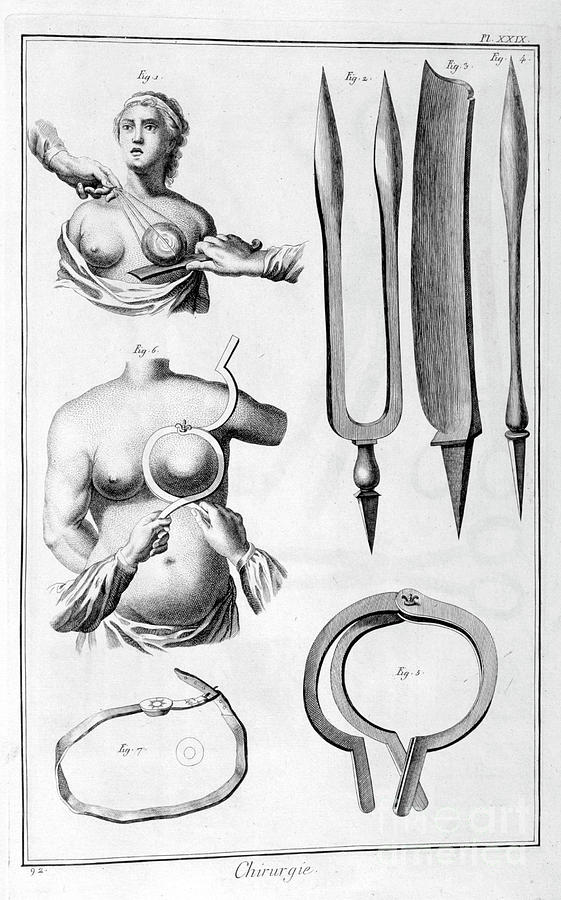 Breast Surgery, 1751-1777 #1 Drawing by Print Collector