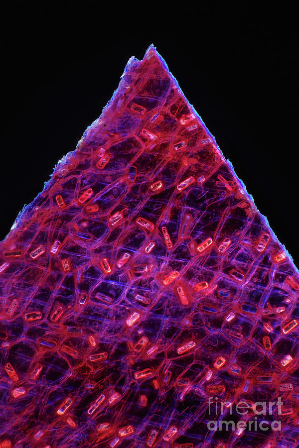 Calcium Oxalate Crystals In Onion Peel #1 Photograph by Marek Mis/science Photo Library