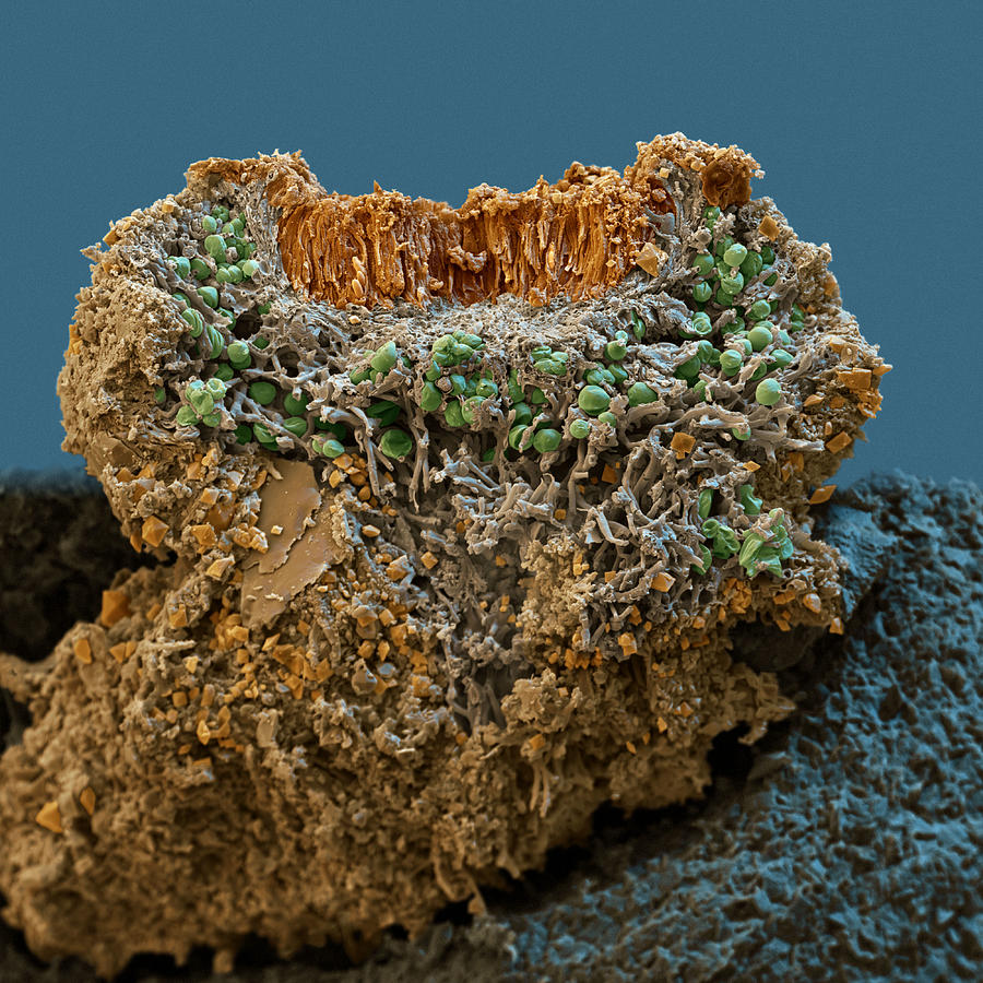 Caloplaca Saxicola Lichen #1 Photograph by Meckes/ottawa