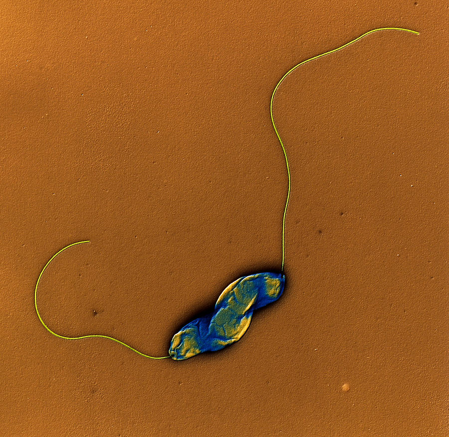 Campylobacter Jejunii Bacteria #1 Photograph by Meckes/ottawa