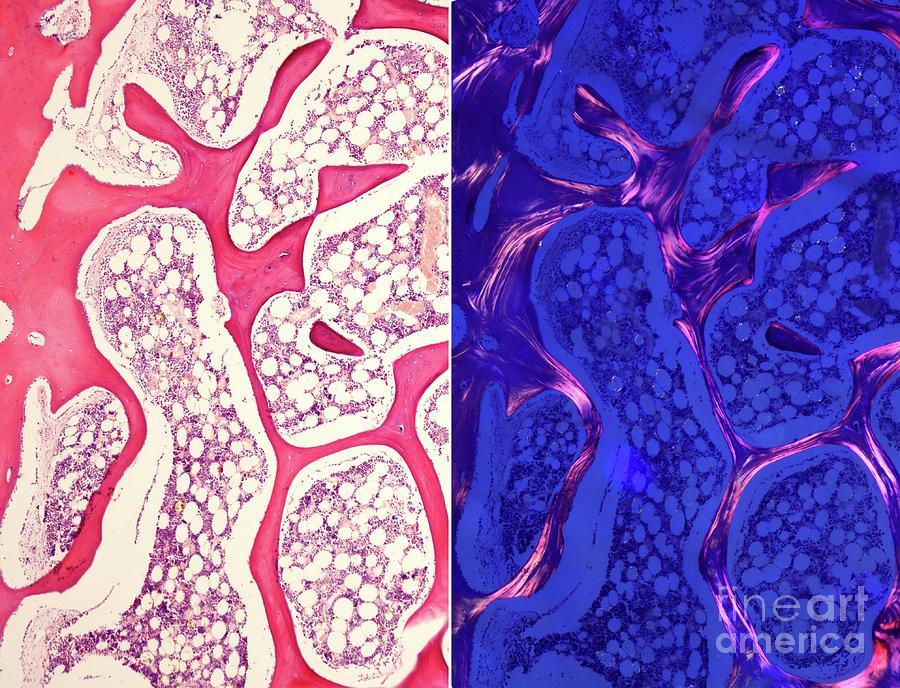 Cancellous Bone Photograph by Jose Calvo / Science Photo Library - Fine