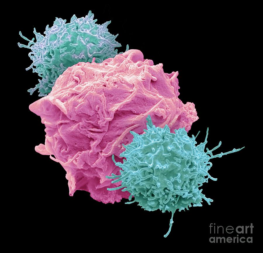 Car T Cell Immunotherapy Photograph By Steve Gschmeissner Science Photo Library