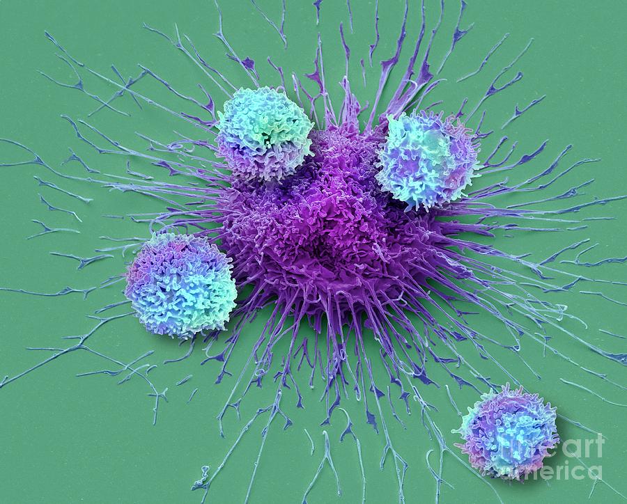 Car T Cell Therapy Photograph By Steve Gschmeissner Science Photo Library Pixels