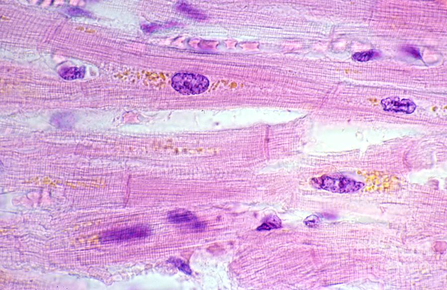 Cardiac Myocytes #1 Photograph by Jose Calvo/science Photo Library