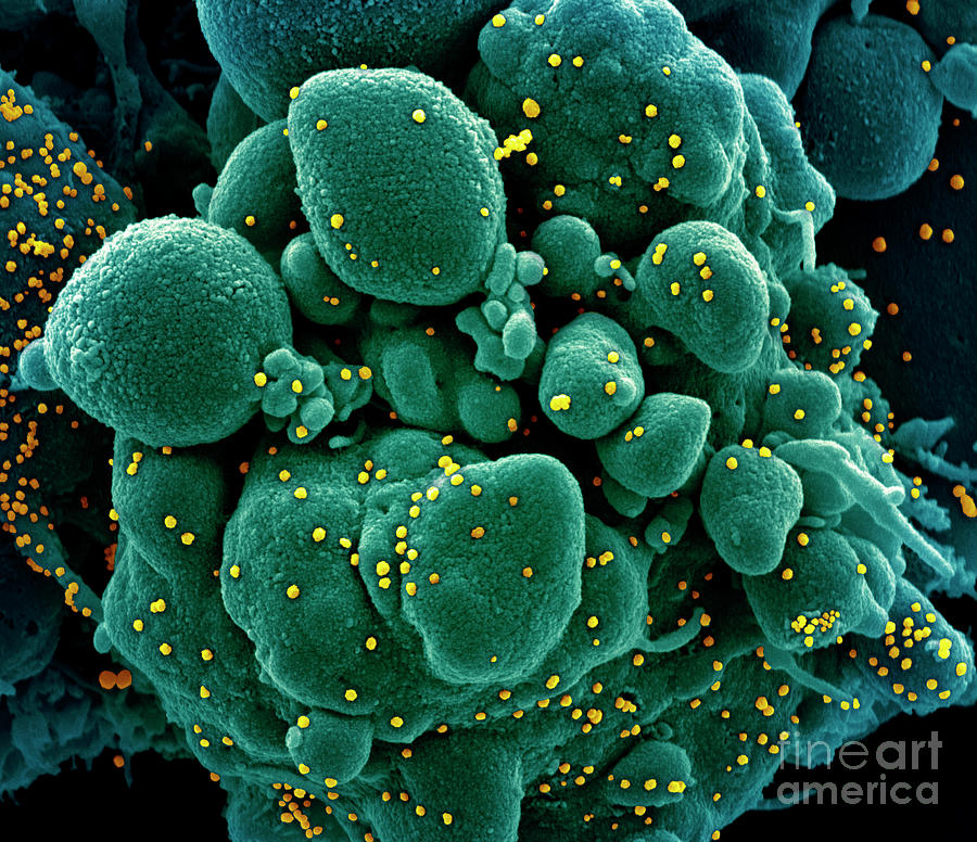 Cell Infected With Covid-19 Coronavirus Particles Photograph by Niaid ...