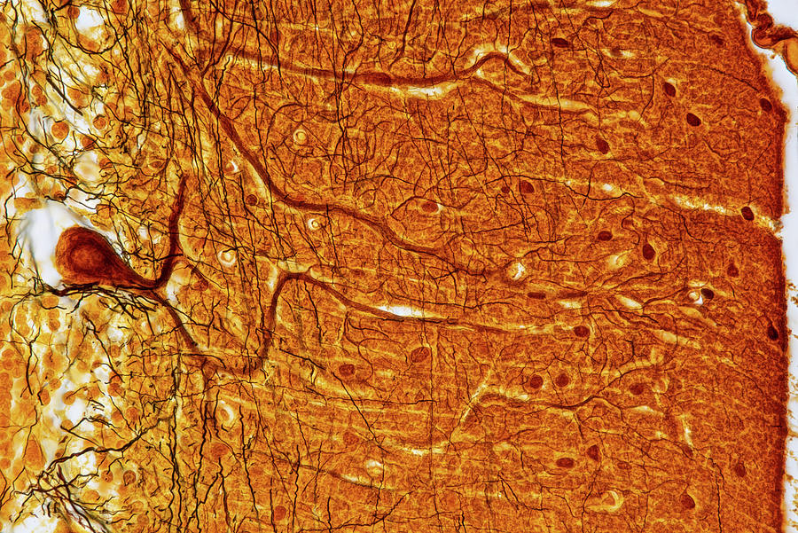 Cerebellum, Lm #1 Photograph by Oliver Meckes EYE OF SCIENCE