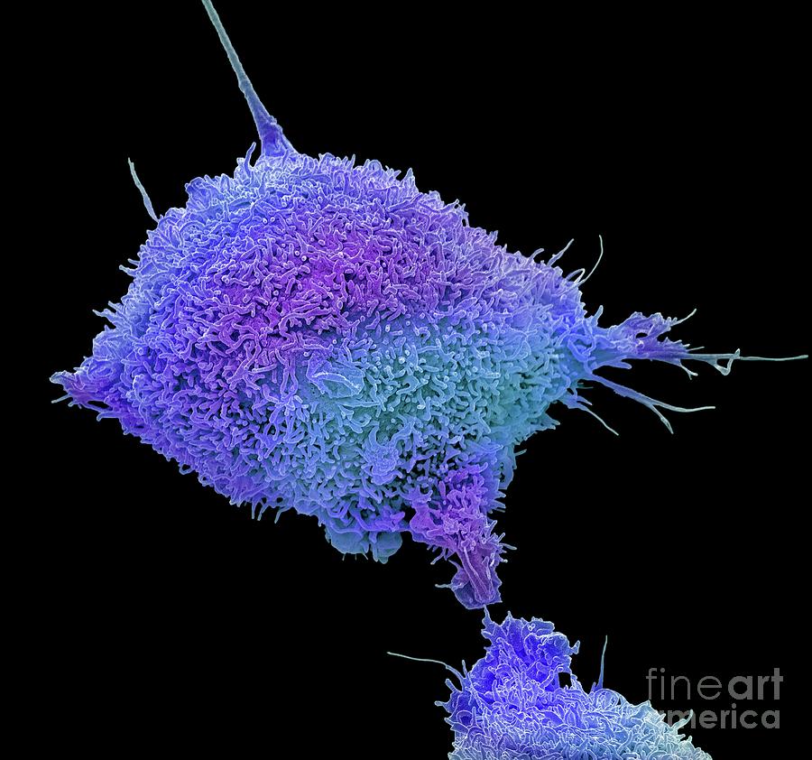 Cervical Cancer Cell #1 Photograph by Steve Gschmeissner/science Photo Library