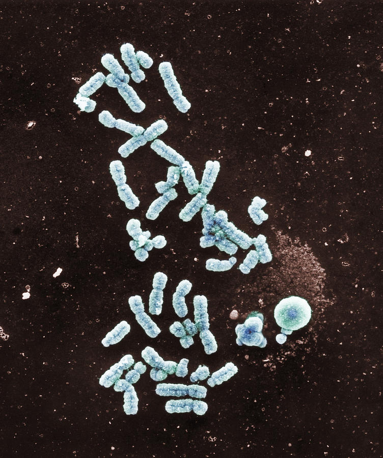 Chromosomes, Sem #1 Photograph by Biophoto Associates