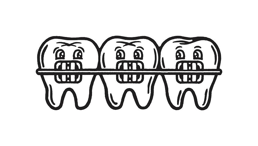 black braces for teeth