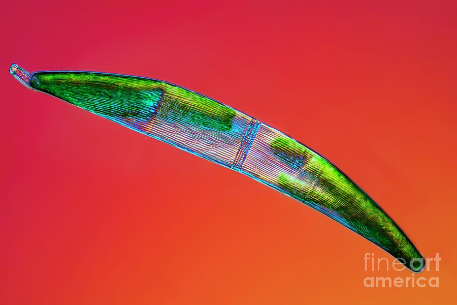 Closterium Desmid Photograph by Frank Fox/science Photo Library - Fine ...