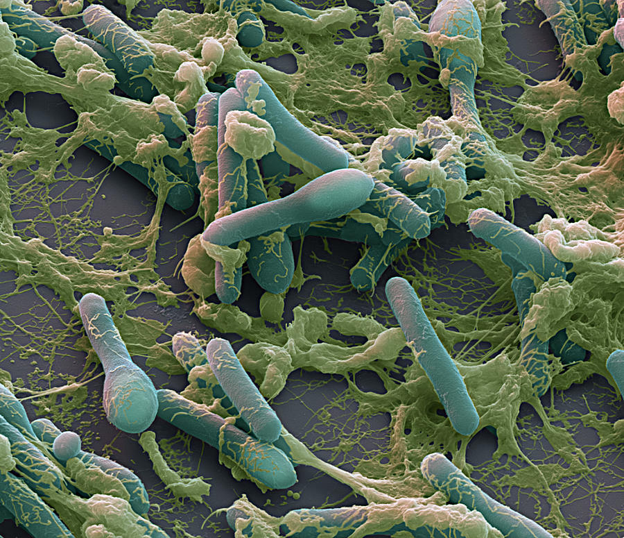 Clostridium Botulinum, Sem #1 Photograph by Oliver Meckes EYE OF SCIENCE