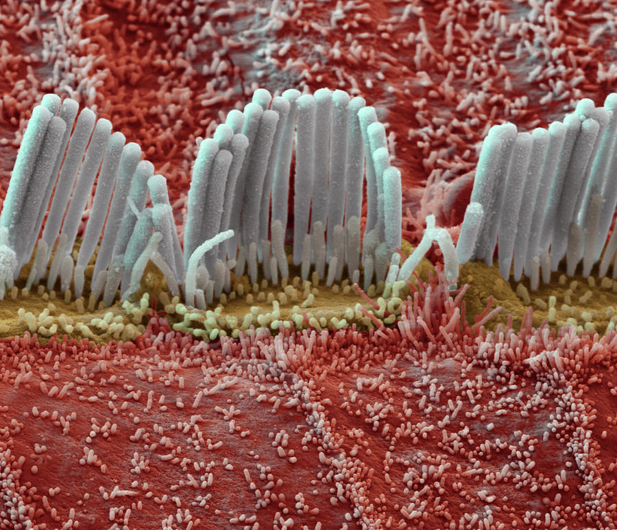 cochlea-inner-hair-cells-sem-photograph-by-oliver-meckes-eye-of