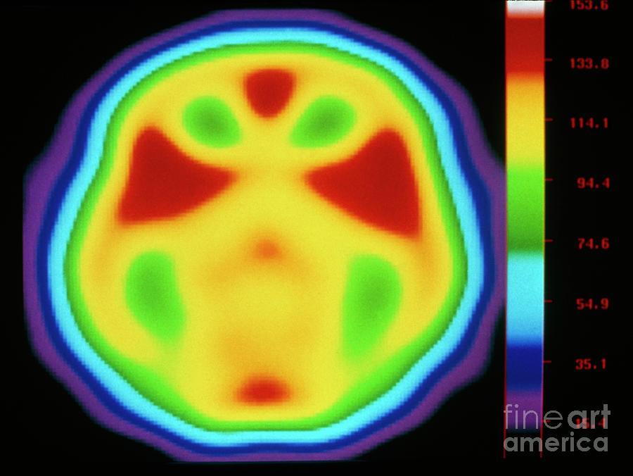 Coloured Pet Brain Scan During Listening Exercise #1 Photograph by Montreal Neurological Institute/science Photo Library