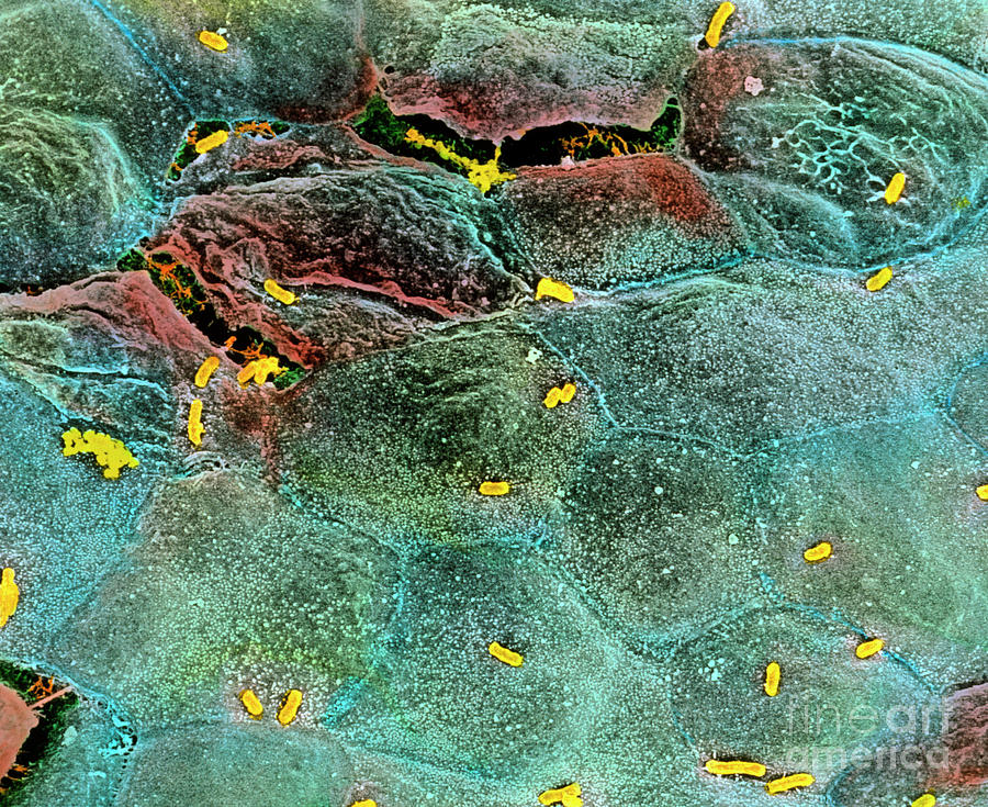 coloured-sem-of-e-coli-infection-of-the-bladder-photograph-by