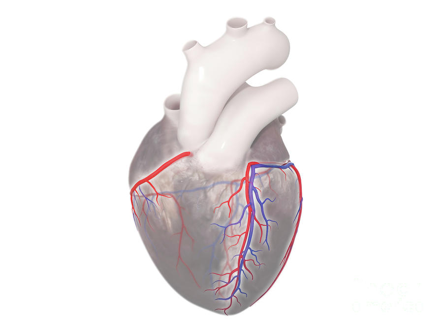 Coronary Vessels Photograph by Medical Graphics/michael Hoffmann ...