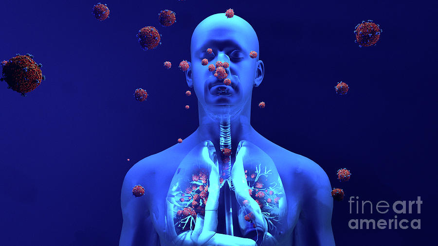 Coronavirus Lung Infection #1 Photograph by Design Cells/science Photo ...