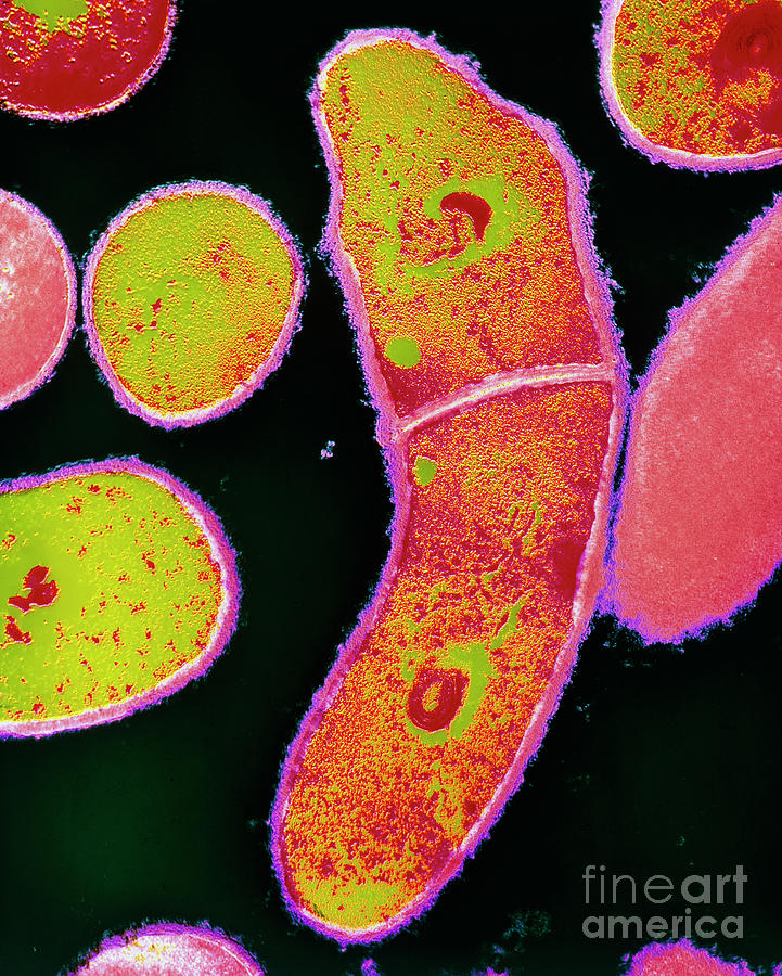 diphtheria bacteria structure