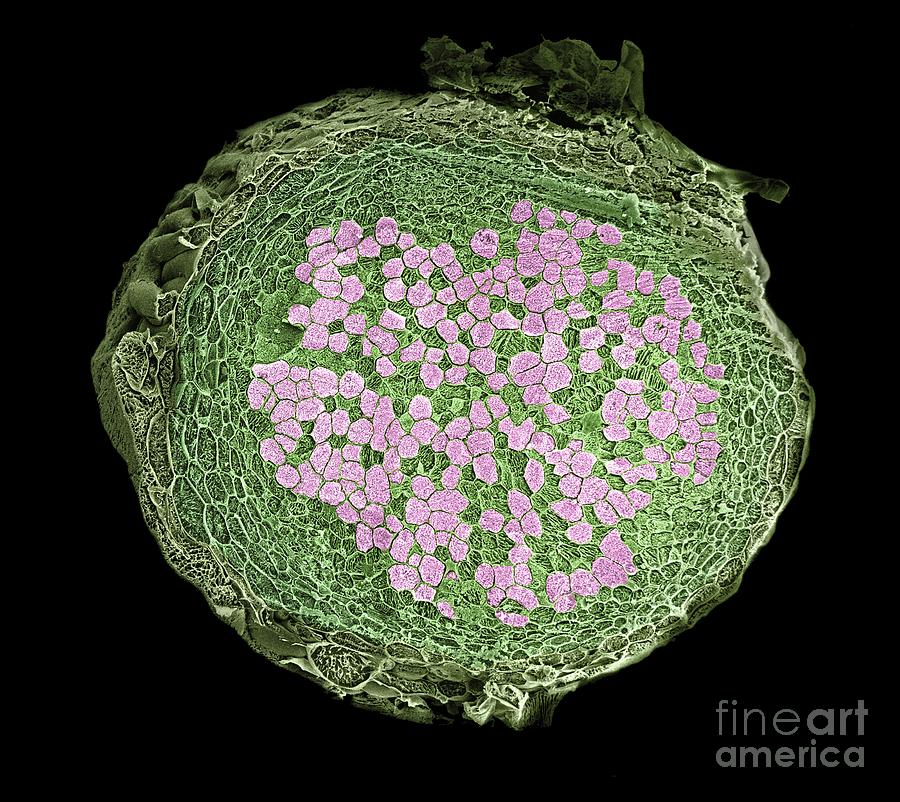 Cross Section Of A Pea Root Nodule #1 Photograph by Dr Jeremy Burgess/science Photo Library