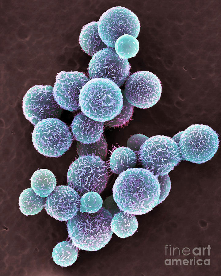 Cryptococcus Neoformans Yeast Photograph By Dennis Kunkel Microscopy