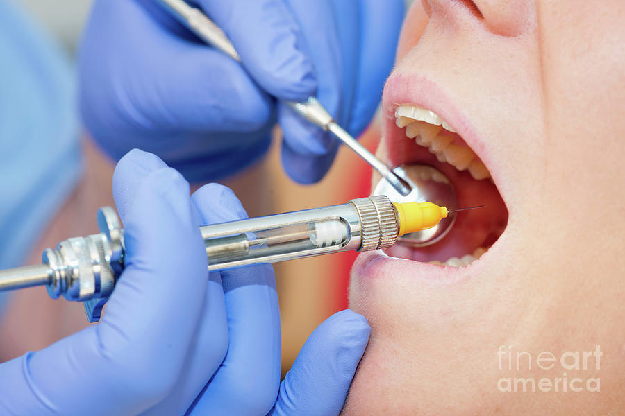 Dental Anaesthesia By Microgen Images Science Photo Library