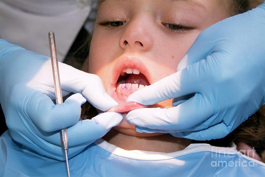 Dental Examination #1 Photograph by Hannah Gal/science Photo Library