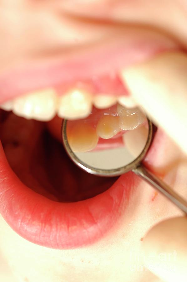 Dental Examination #1 Photograph by Medicimage / Science Photo Library