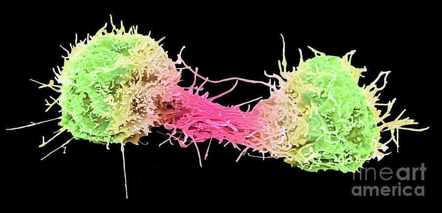 Dividing Lung Cancer Cell #1 Photograph by Steve Gschmeissner/science Photo Library