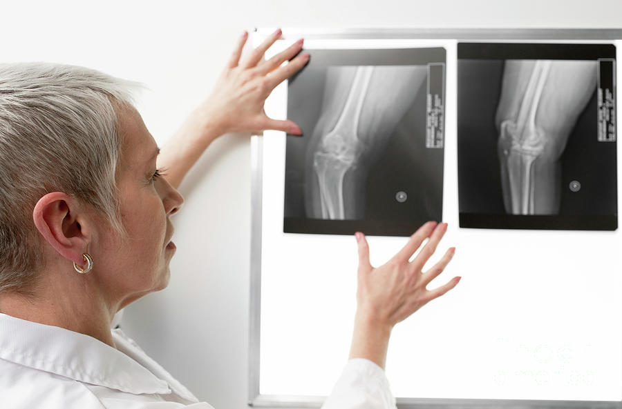 Doctor Examining Knee X-ray #1 Photograph by Peakstock / Science Photo Library