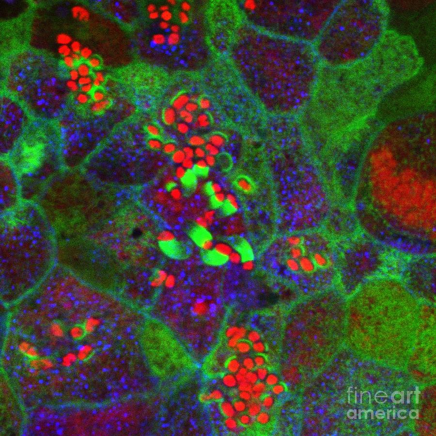 E. Coli Bacteria In Small Intestine Photograph by Stephanie Schuller ...