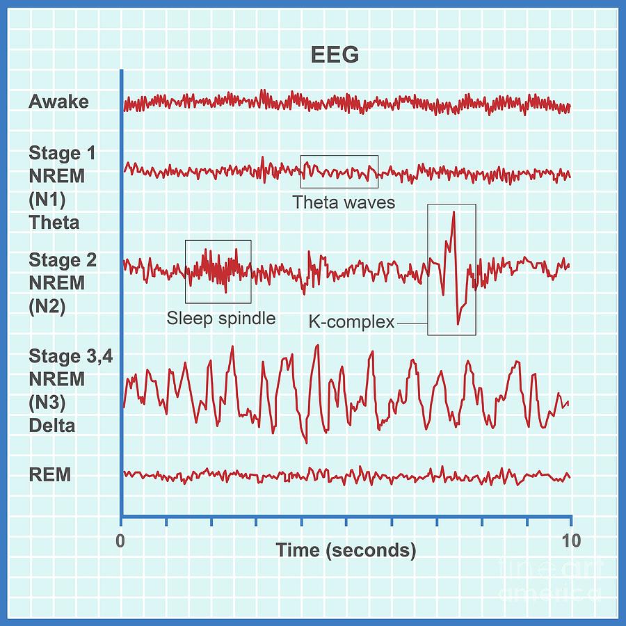 Eeg Sleep Stages #1 Photograph by Cordelia Molloy/science Photo Library