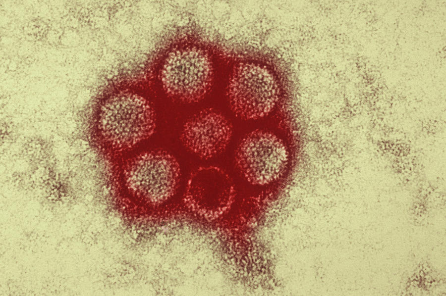 Electron Micrograph Of Canine Adenovirus Digital Art by Callista Images ...
