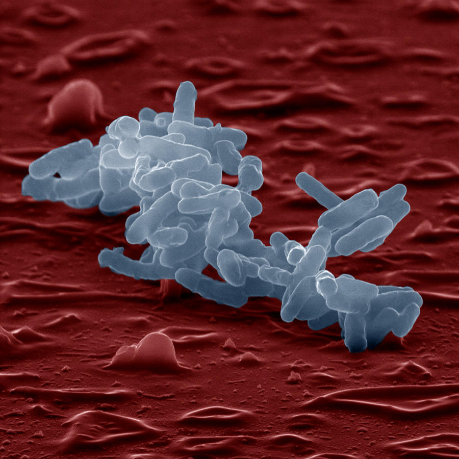 Enterobacter Cloacae #1 Photograph by Meckes/ottawa