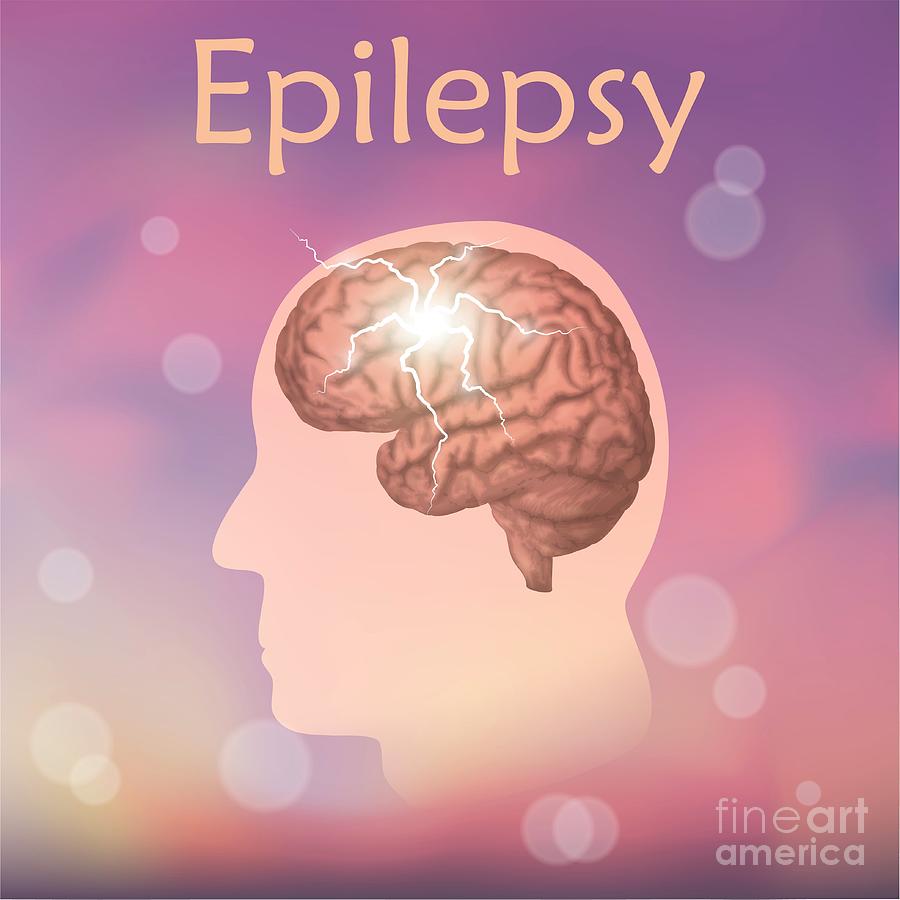 Epilepsy Photograph By Veronika Zakharovascience Photo Library 9003