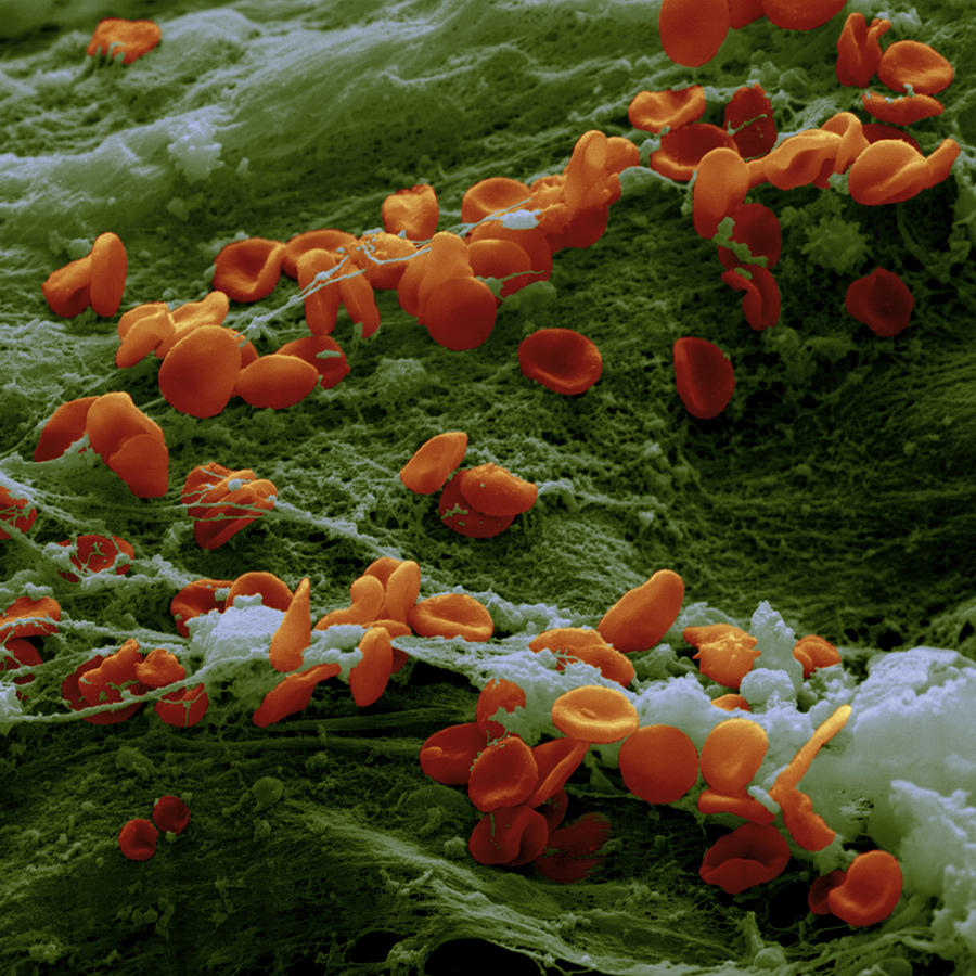 Erythrocytes And Fibrin Threads #1 Photograph by Meckes/ottawa