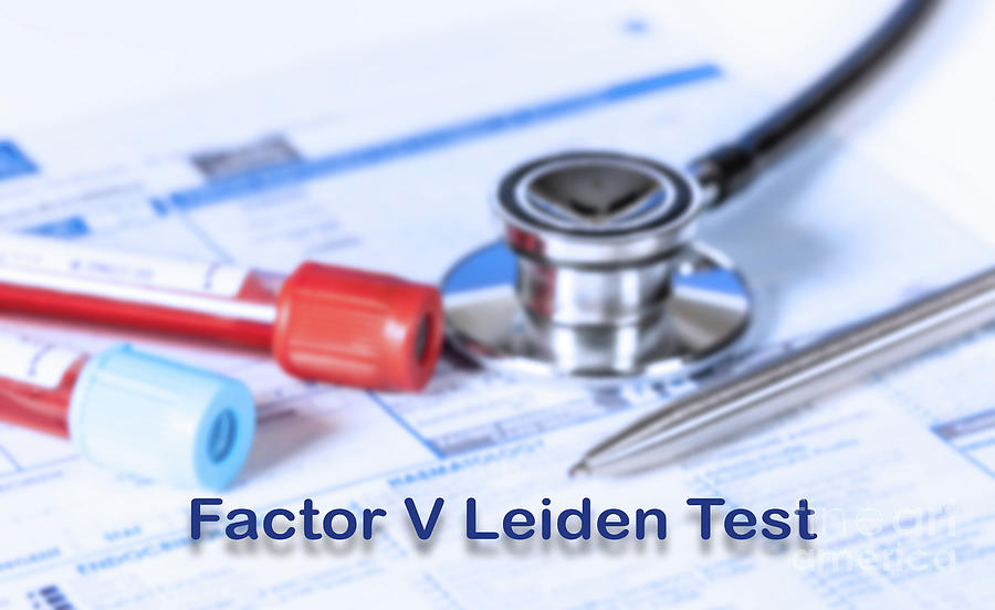 Factor V Leiden Test Photograph by Wladimir Bulgar/science Photo ...