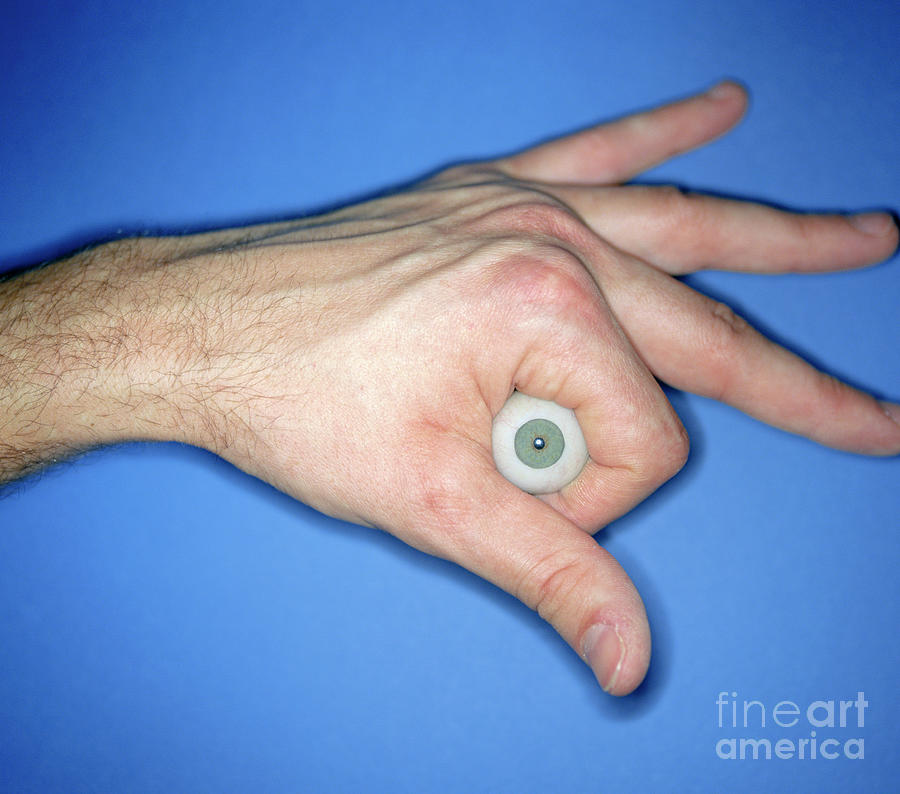False Eye #1 Photograph by Lawrence Lawry/national Artificial Eye Service/science Photo Library