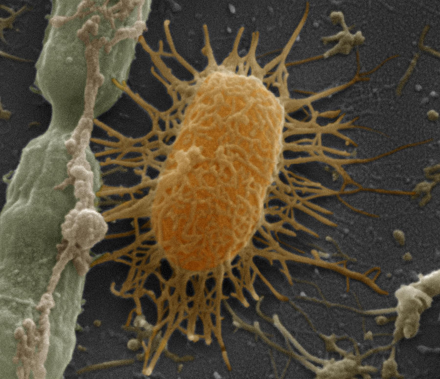 Fecal Bacteria #1 Photograph by Meckes/ottawa