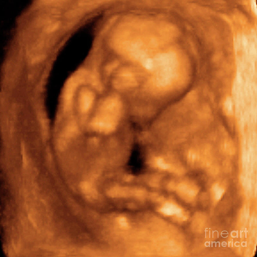 Foetus At 14 Weeks #1 Photograph by Dr Najeeb Layyous/science Photo Library