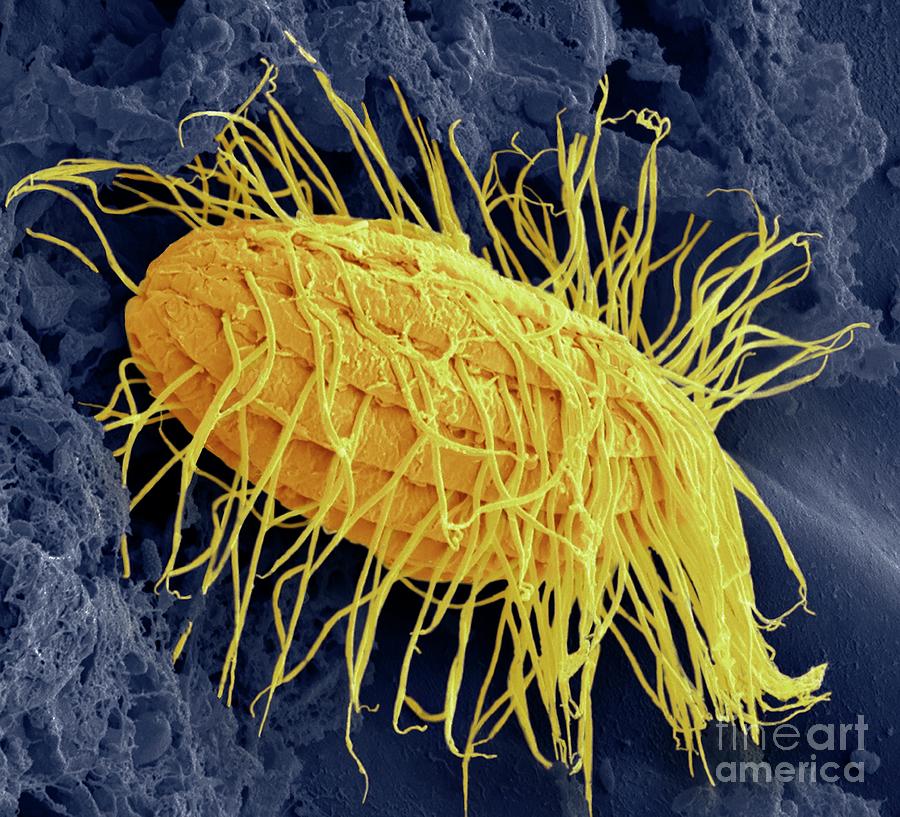 Fresh Water Ciliate Protozoan #1 Photograph by Steve Gschmeissner/science Photo Library