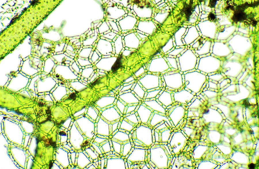 Freshwater Alga #1 Photograph by Dr Keith Wheeler/science Photo Library