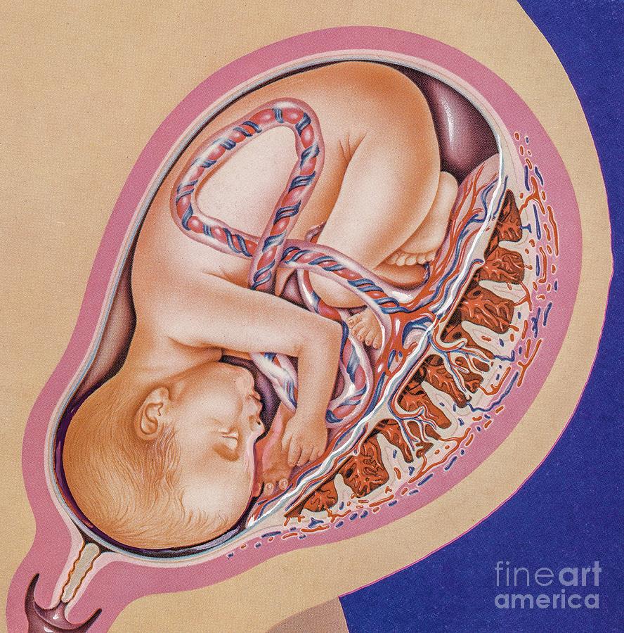 Рождение ребенка с плацентой. 3 роды 40 недель