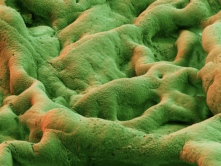Gallbladder, Sem #1 Photograph by Eye Of Science