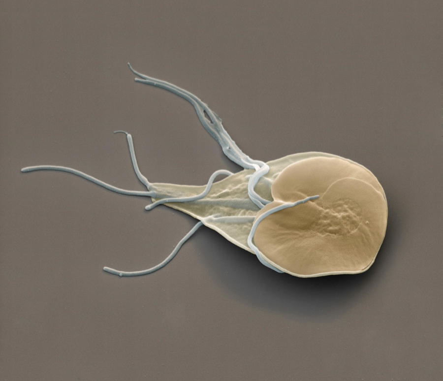 Giardia Lamblia Photograph by Eye of Science Fine Art America
