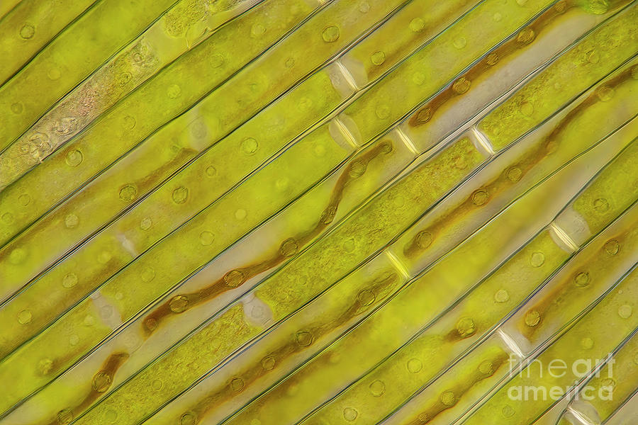 Gonatozygon Kinahanii Algae #1 Photograph by Frank Fox/science Photo Library