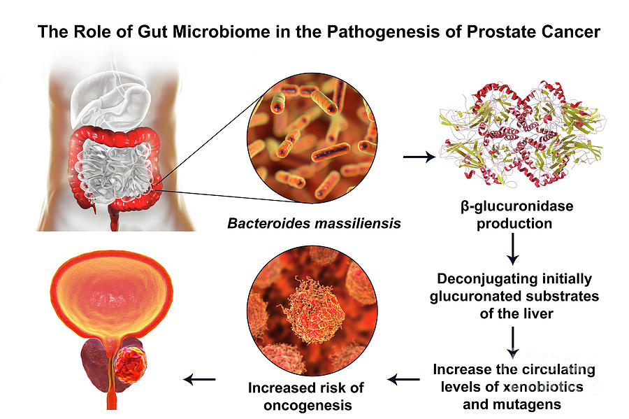 Dimensional Photograph - Gut Microbiome And Prostate Cancer #1 by Kateryna Kon/science Photo Library