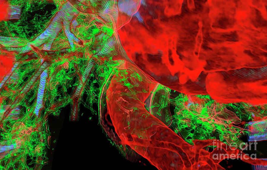 Heart And Aorta Photograph by Vsevolod Zviryk/science Photo Library ...