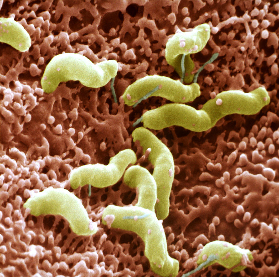 Helicobacter Pylori #1 Photograph by Meckes/ottawa